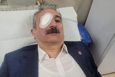 CHP İl Başkanı Nihat Yeşiltaş eylemde yaralandı